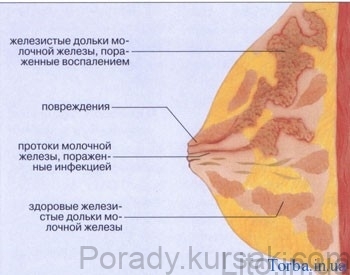 mastyt
