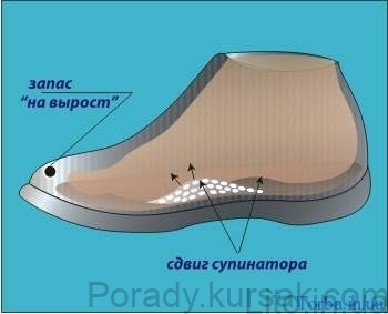 supinator2